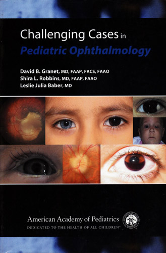 #Biblioinforma | CHALLENGING CASES IN PEDIATRIC OPHTHALMOLOGY