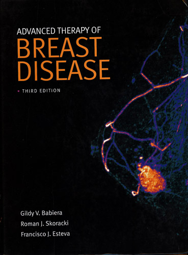 #Biblioinforma | ADVANCED THERAPY OF BREAST DISEASE