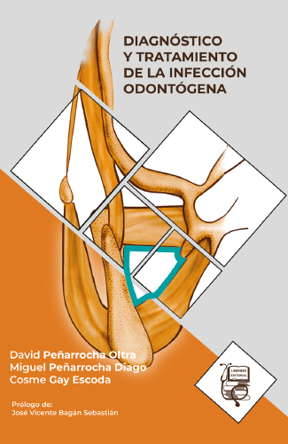 #Biblioinforma | Diagnóstico y tratamiento de la infección odontógena