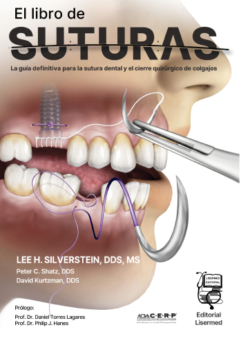 #Biblioinforma | El libro de SUTURAS. La guía definitiva para la sutura dental y el cierre quirúrgico de colgajos