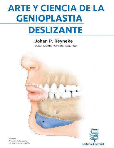 #Biblioinforma | Arte y ciencia de la genioplastia deslizante