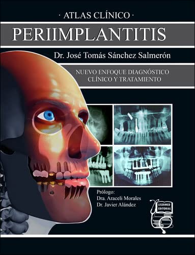 #Biblioinforma | Atlas clínico de periimplantitis