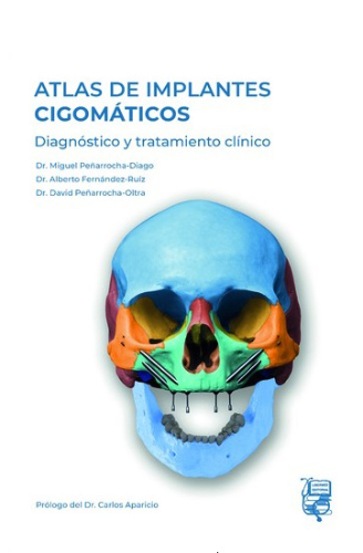 #Biblioinforma | Atlas de implantes cigomáticos: diagnóstico y tratamiento clínico