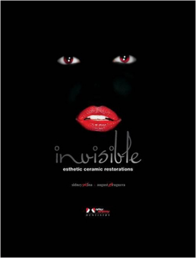 #Biblioinforma | INVISIBLE ESTHETIC CERAMIC RESTORATIONS
